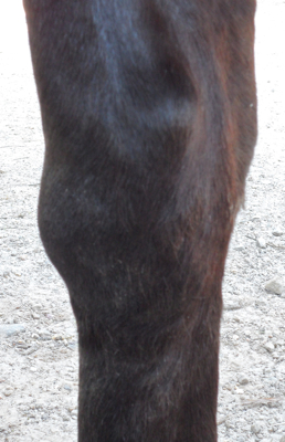 Hygroma A